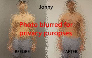 Jonny Before & After