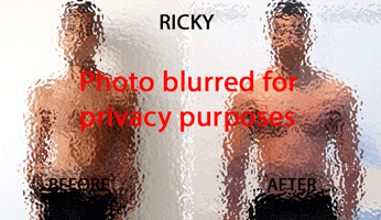 Jonny Before & After